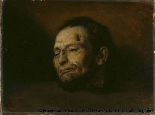 (Abb. 5) Hugues Fourau. Tête décapitée de Fieschi. 1836